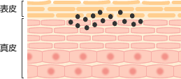 単純黒子 皮膚断面図