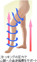 医療用弾性ストッキングの役割