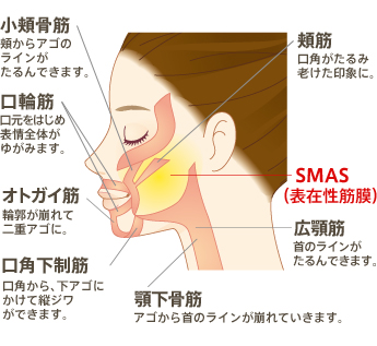 小頰骨筋 頬からアゴのラインがたるんできます。 口輪筋 口元をはじめ表情全体がゆがみます。 オトガイ筋 輪郭が崩れて二重アゴに。 口角下制筋 口角から、下アゴにかけて縦ジワができます。 類筋 口角がたるみ老けた印象に。 SMAS(表在性筋膜) 広顎筋 首のラインがたるんできます。 顎下骨筋 アゴから首のラインが崩れていきます。