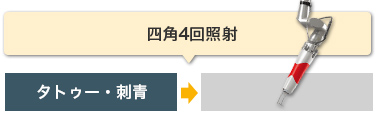 四角4回照射 タトゥー・刺青