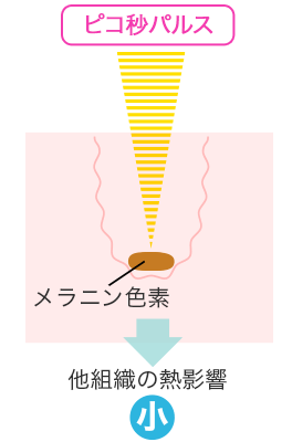 ピコ秒パルス 他組織の熱影響 小