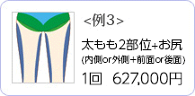 ＜例3＞ 太もも2部位+お尻（内側or外側＋前面or後面） 1回 627,000円
