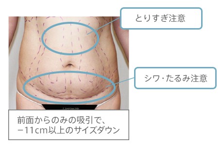 デザインについて