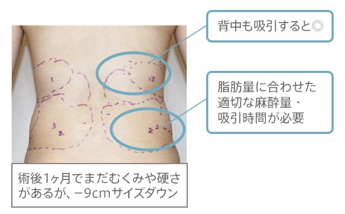 デザインについて