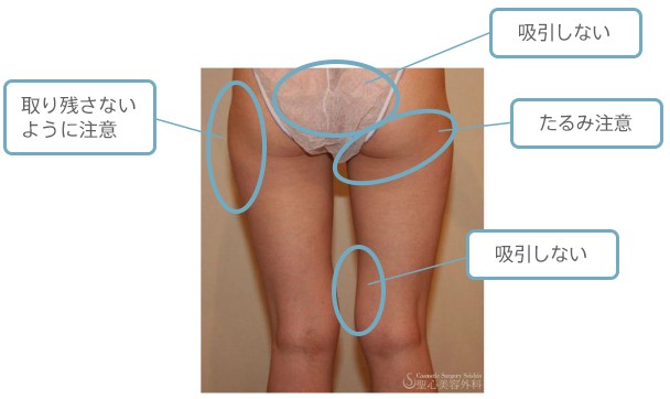 デザインについて