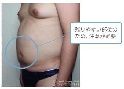 デザインについて