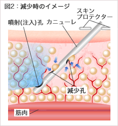 図2:減少時のイメージ