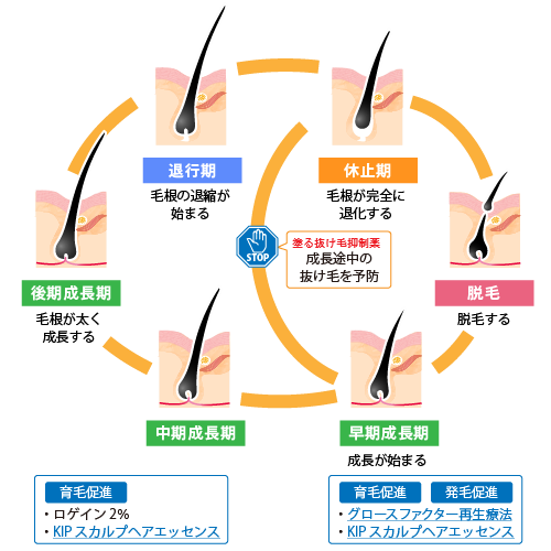 パントスチン：成長期途中の抜け毛を予防。育毛促進：・ロゲイン2% ・KIPスカルプヘアエッセンス。育毛促進・発毛促進：・グロースファクター再生療法 ・KIPスカルプヘアエッセンス