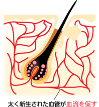 太く新生された血管が血流を改善