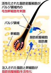 注入された脂肪と幹細胞が脂肪前駆細胞を活性化　活性化された脂肪前駆細胞がバルジ領域内の毛包幹細胞を刺激