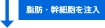 ↓脂肪・幹細胞を注入