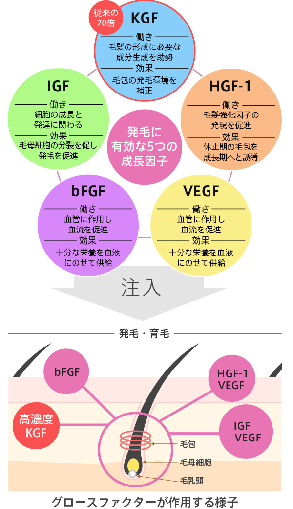 KGF(ケラチン細胞増殖因子) -働き- 毛髪の形成に必要な成分生成を助勢 -効果- 毛包の発毛環境を補正 HGF-1(肝細胞増殖因子) -働き- 毛髪強化因子の 発現を促進 -効果- 休止期の毛包を成長期へと誘導 VEGF(血管内皮細胞増殖因子) -働き- 血管に作用し血流を促進 -効果- 十分な栄養を血液にのせて供給 bFGF(線維芽細胞増殖因子) -働き- 血管に作用し血流を促進 -効果- 十分な栄養を血液にのせて供給 IGF(インスリン様成長因子) -働き- 細胞の成長と発達に関わる -効果- 毛母細胞の分裂を促し発毛を促進 発毛に有効な5つの成長因子 注入 発毛・育毛 グロースファクターが作用する様子