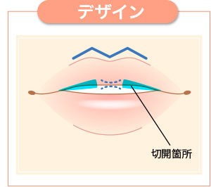 デザイン