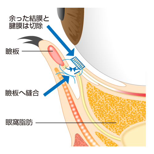 眼球 図