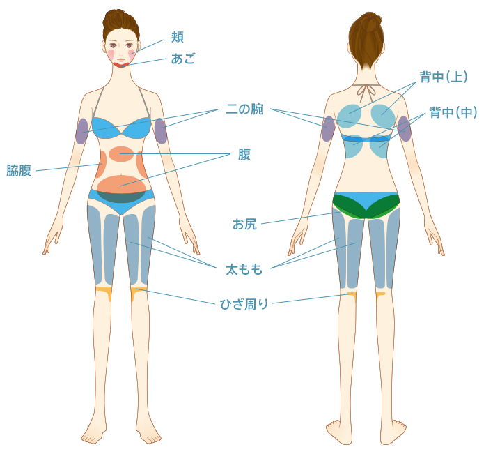 頬 あご 脇腹 背中(上) 背中(中) 二の腕 腹 お尻 太もも ひざ周り