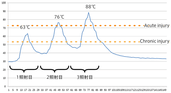 照射 図