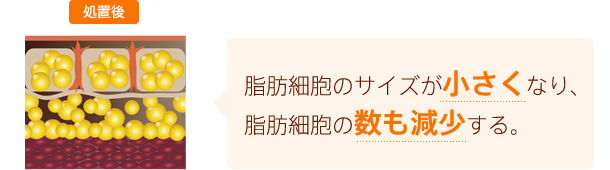 脂肪細胞のサイズが小さくなり、脂肪細胞の数も減少する。