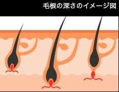 毛根の深さのイメージ図