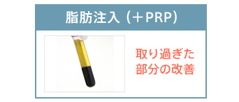 脂肪注入（+PRP） 取り過ぎた部分の改善