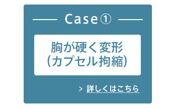 Case① 胸が硬く変形（カプセル拘縮） 詳しくはこちら