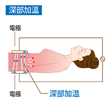 少血小板血漿