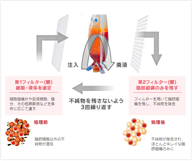 ピュアグラフトの高性能フィルター