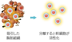 吸引した脂肪細胞 分離すると幹細胞が活性化