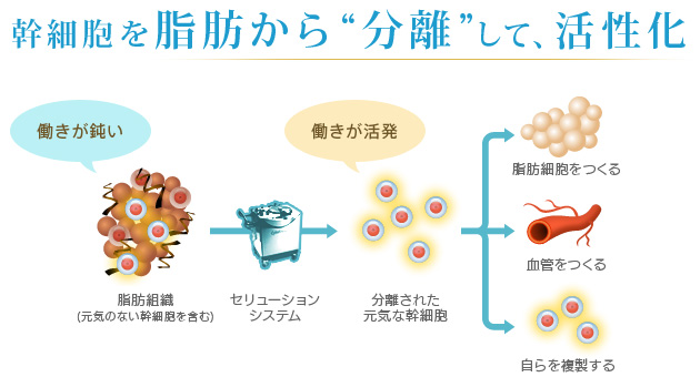 幹細胞を脂肪から“分離”して、活性化 働きが鈍い 脂肪組織（元気のない幹細胞を含む） セリューションシステム 動きが活発 分離された元気な幹細胞 脂肪細胞をつくる 血管をつくる 自らを複製する