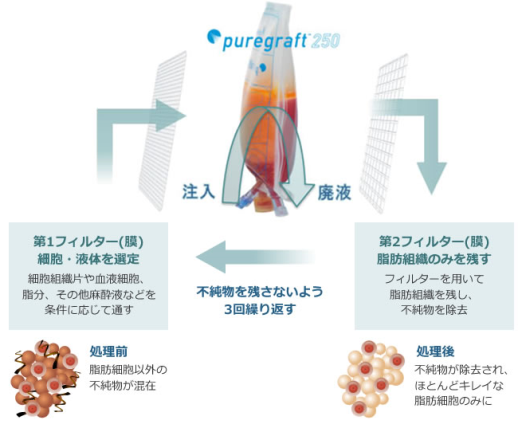 脂肪から不純物除去して濃縮