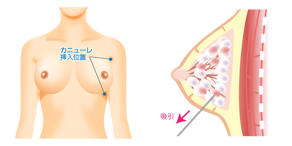 施術方法