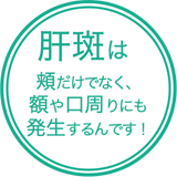 肝斑は頬だけでなく、額や口周りにも発生するんです！