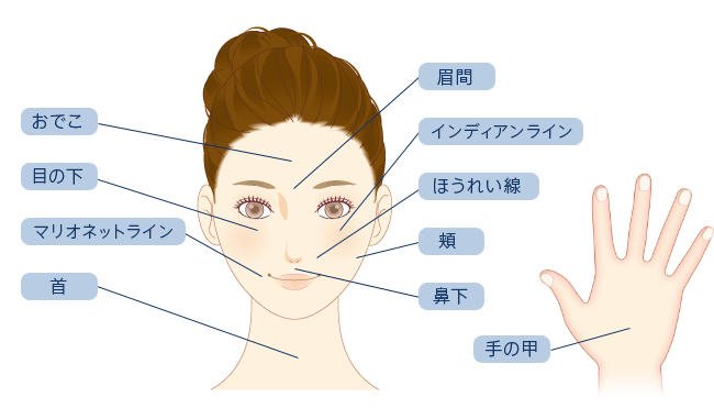 おでこ 目の下 マリオネットライン 首 眉間 インディアンライン ほうれい線 頬 鼻下 手の甲