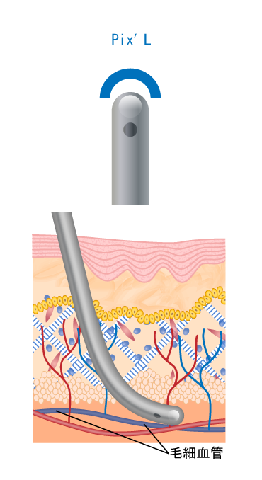 Pix'L 毛細血管