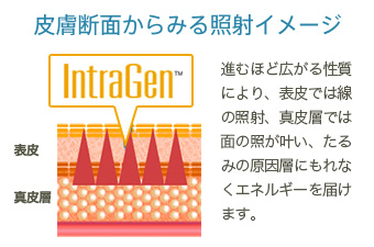 皮膚断面からみる照射イメージ　進むほど広がる性質により、表皮では線の照射、真皮層では面の照射が叶い、たるみの原因層にもれなくエネルギーを届けます。