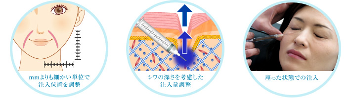 mmよりも細かい単位で注入位置を調整、シワの深さを考慮した注入量調整、座った状態での注入