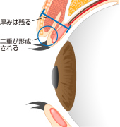 施術後