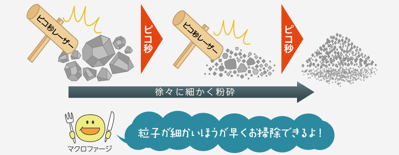 ピコ秒レーザー ピコ秒 徐々に細かく粉砕 粒子が細かいほうが早くお掃除できるよ！