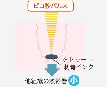 ピコ秒パルス 他組織の熱影響 小