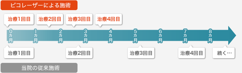 【ピコレーザーによる施術】治療1回目、治療2回目、治療3回目、治療4回目　【当院の従来施術】治療1回目、治療2回目、治療3回目、治療4回目、続く……