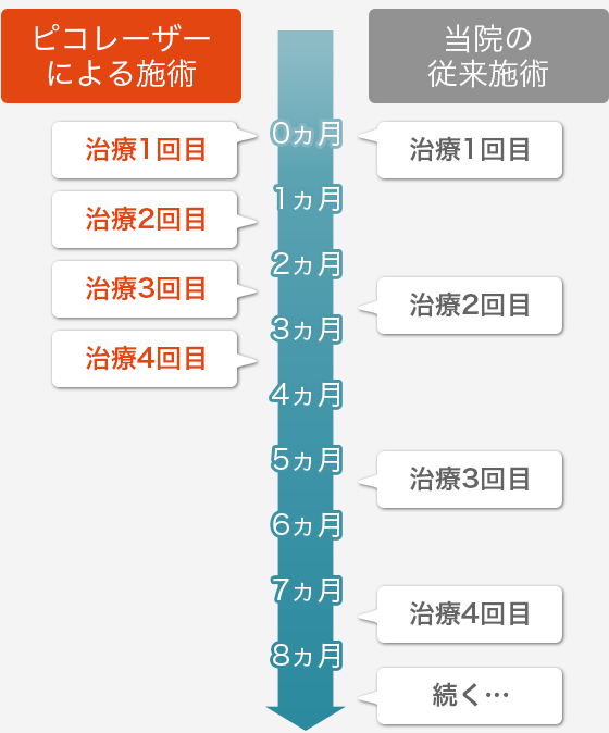 【ピコレーザーによる施術】治療1回目、治療2回目、治療3回目、治療4回目　【当院の従来施術】治療1回目、治療2回目、治療3回目、治療4回目、続く……