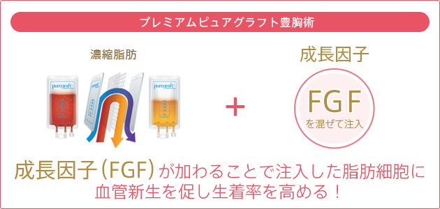 プレミアムピュアグラフト豊胸術 濃縮脂肪 + 成長因子 FGFを混ぜて注入 成長因子（FGF）が加わることで注入した脂肪細胞に血管新生を促し生着率を高める！