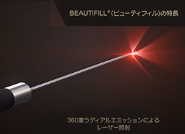 BEAUTIFILL（ビューティフィル）の特長 360度ラディアルエミッションによるレーザー照射