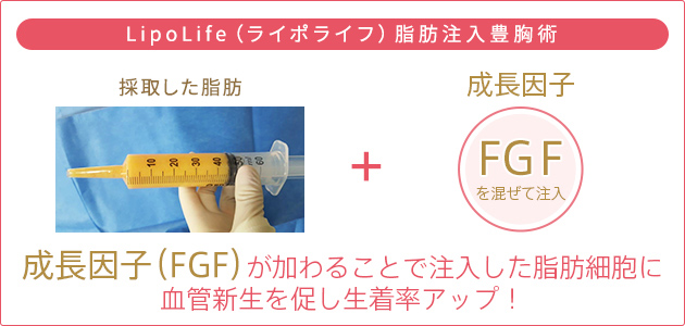 プレミアム LipoLife（ライポライフ）脂肪注入豊胸術