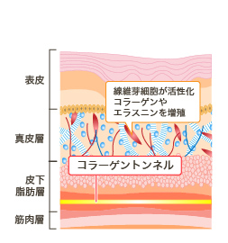 線維芽細胞が活性化 コラーゲンやエラスチンを増殖 コラーゲントンネル