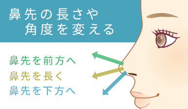 鼻先の長さや角度を変える 鼻先を前方へ 鼻先を長く 鼻先を下方へ