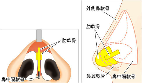 鼻 図