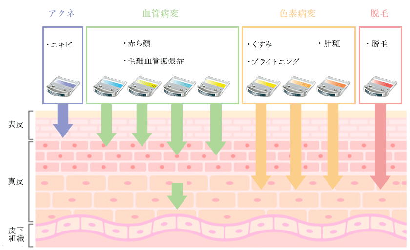 様々な光の照射方法