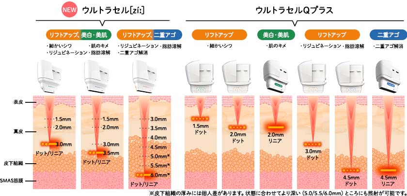 医師が肌状態に合わせて照射深度を調整