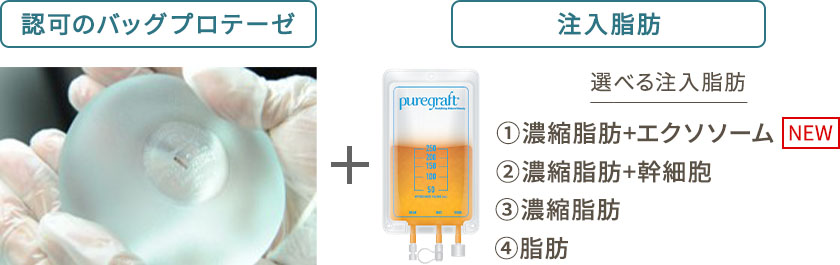 認可のバッグプロテーゼ+注入脂肪 選べる注入脂肪 ①濃縮脂肪+エクソソーム NEW ②濃縮脂肪+幹細胞 ③濃縮脂肪 ④脂肪