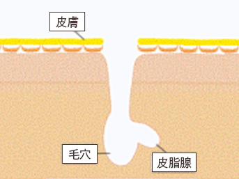 毛穴（開き・黒ずみ）